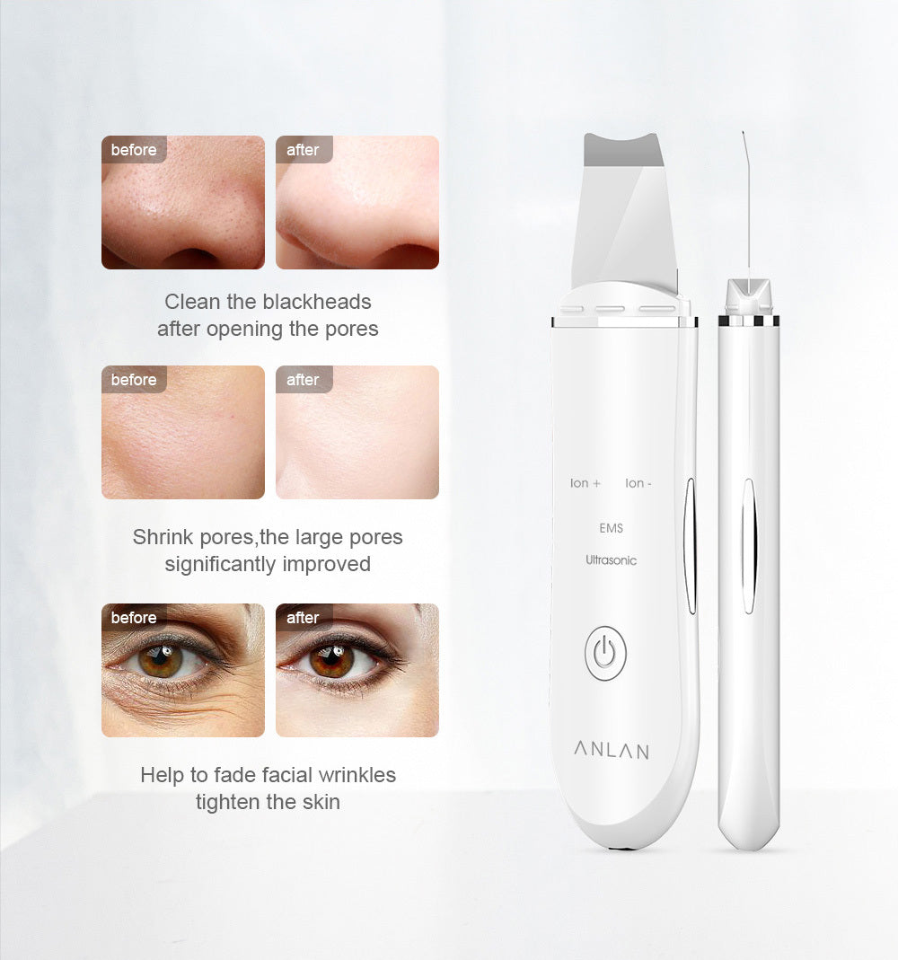 Ultrasonic Skin Scrubber Deep Face Cleaning Machine